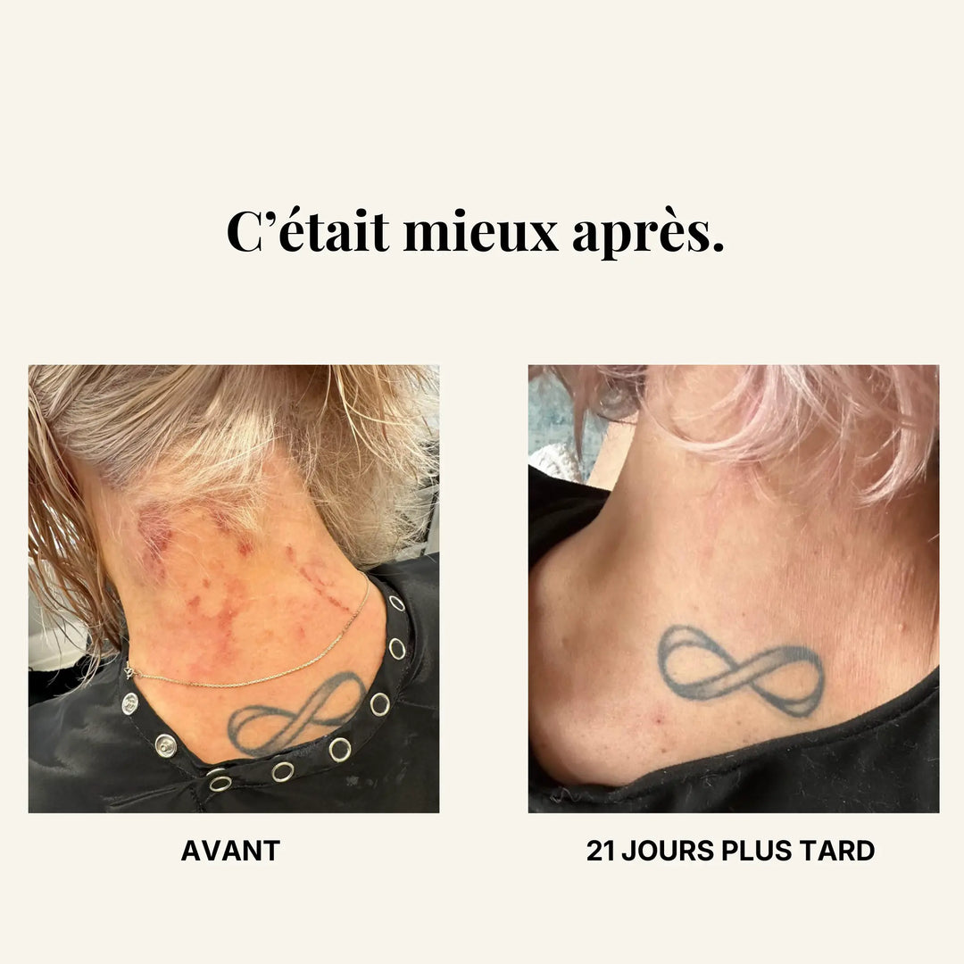 Résultats avant-après suite à la prise de zinecol.