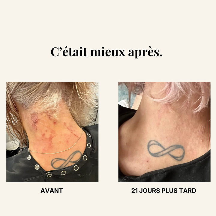 Résultats avant-après suite à la prise de zinecol.