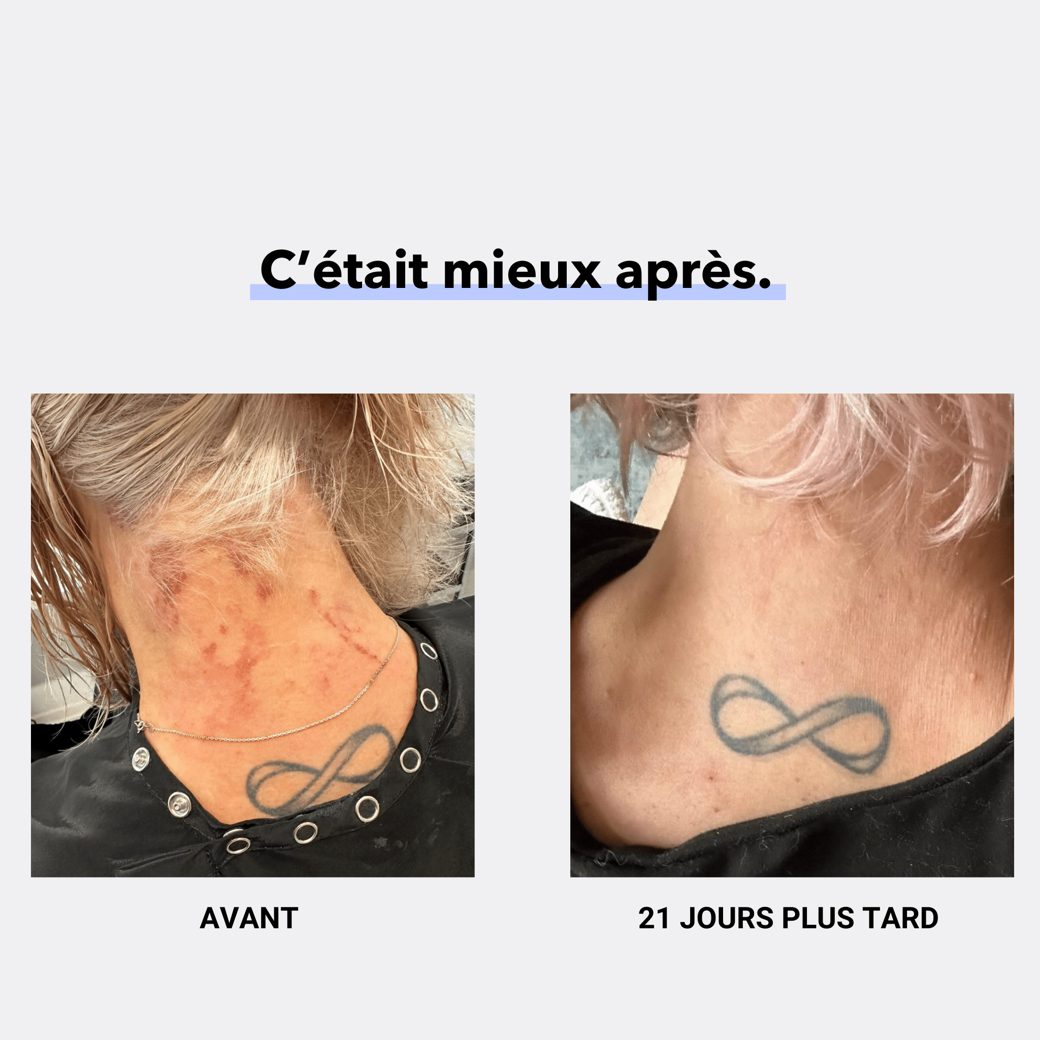 ZINECOL® Zinc liquide - LABORATOIRES BIORNIZ