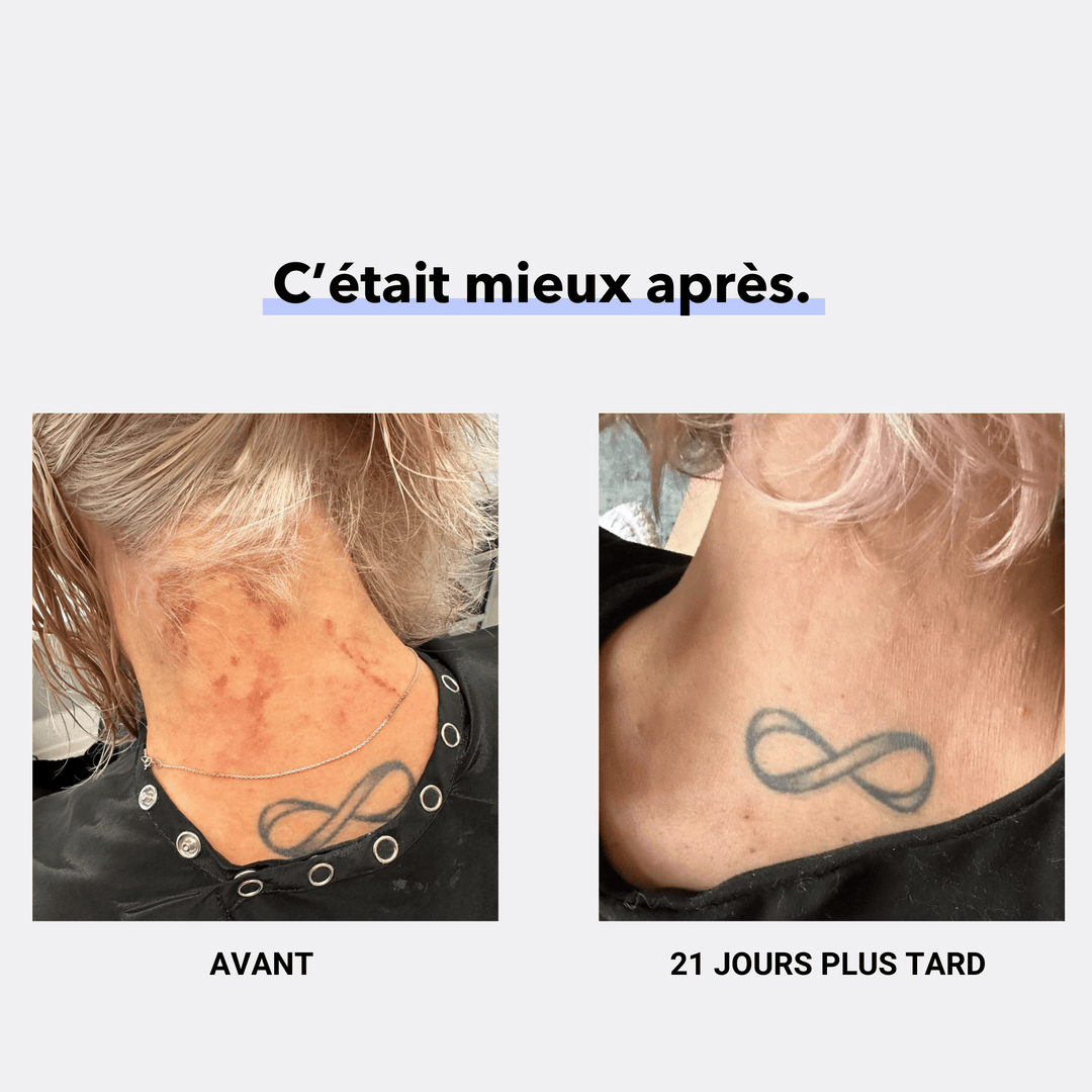ZINECOL® Zinc liquide - LABORATOIRES BIORNIZ