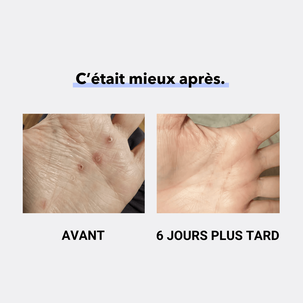 ZINECOL® Zinc liquide - LABORATOIRES BIORNIZ